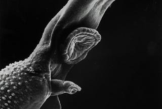 Signs America Has a Parasite*