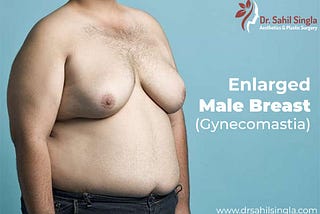 Enlarged Male Breast (Gynecomastia)