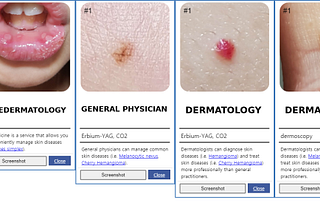 Model Dermatology — More Accurate Than Googling