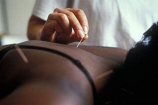 是「針」是假？針灸能治療乳癌藥物所帶來的疼痛
