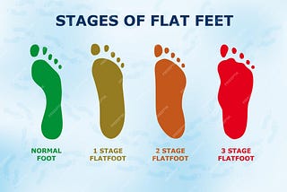 Mastering Flat Feet Management: Your Ultimate Guide to Orthotic Insoles and Lifestyle Adjustments