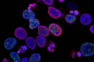 CRISPR and allogenic CAR-T Cells is revolutionary for cancer treatments