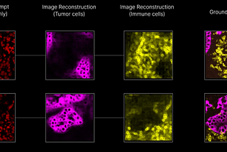 Revolutionizing Cancer Immunotherapy with AI: Wittington Ventures’ Investment in Noetik