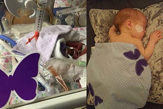 See A Purple Butterfly Sign Around A Baby? Don’t Dare Ask The Parents