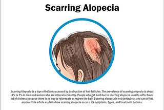 All you need to know about Scarring Hair Loss Disease.