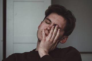 My Alopecia led me to my Narcolepsy Diagnosis