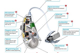 How do Hearing aids work?