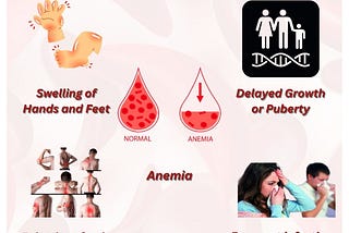 Symptoms of Sickle cell anemia
