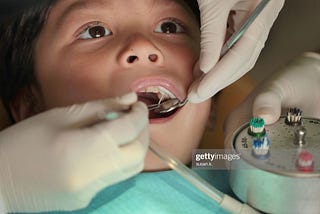 Kids Root Canal