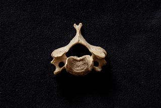 A vertebral segment is pictured on a dark background, in an article written by Dr. Erik Reich a chiropractor in Connecticut.