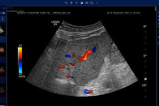 How PACS, RIS, and DICOM Work Together in Modern Medical Imaging