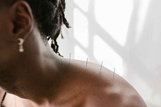 A Pierce for Pain: Does Acupuncture Work?