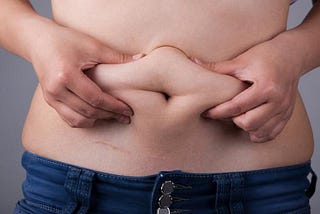 Obesity — what to do?