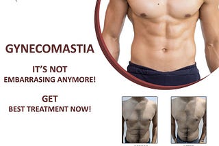 Gynecomastia Surgery: A Guide To Know About It