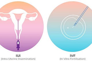 IUI v/s IVF