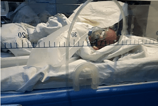 My Premature baby in the NICU