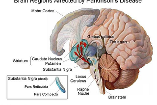 DEEP BRAIN STIMULATION AND PARKINSON’S DISEASE
