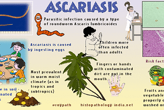 Ascariasis — Know It All!