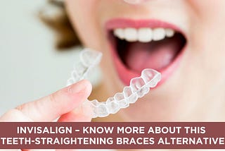 Invisalign — Know more about this Teeth-Straightening Braces Alternative