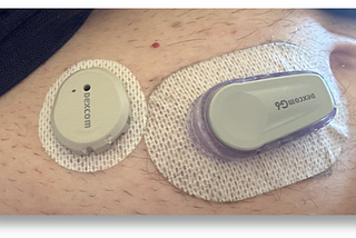 Continuous Glucose Monitors: Does Better Accuracy Mean Better Glycemic Control?