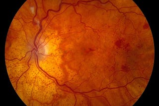 Learn About Common Eye Disorders And Diseases With Dr. Zuhal Butuner