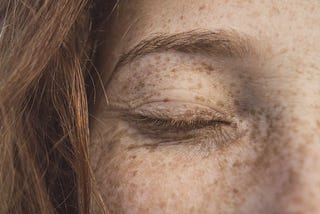 The Story of How My Freckles Returned