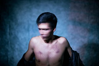 How to Heal Your Narcissist’s Scars by Using Their Savage Skills