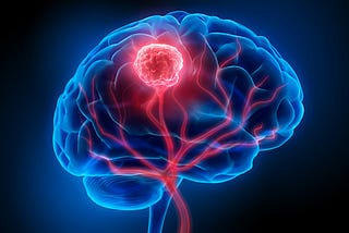 An Introduction to Brain Tumors and Craniotomy Procedures