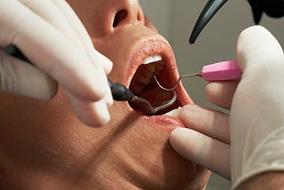 What Is Superannuation Early Release for Dental Treatment?