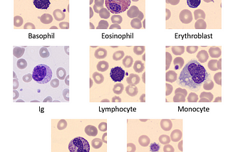 Classification peripheral blood cell