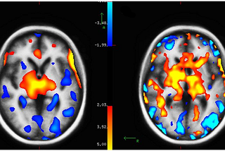 Contrasting radiotracer & non-invasive neuroimaging techniques for regional CBF measurement