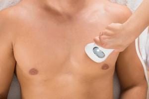 The Three Most Common Areas for Laser Hair Removal for Men