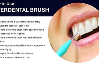 Interdental Brushes: Enhancing Oral Hygiene Practices