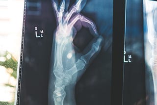 A Step-By-Step Recount of Signing Up For Health Insurance