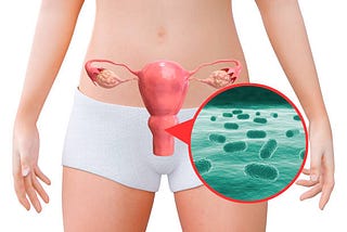 A female reproductive organs, including the uterus, ovaries, cervix, and vagina is shown with a microscopic image of normal flora.