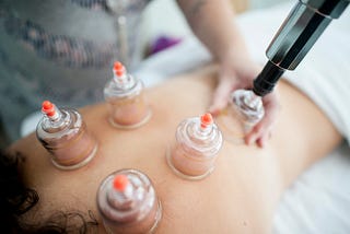 Benefits of Hijama/Wet Cupping Points No: 14, 15, 16, 17, 18.