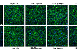 Alternatives to Fetal Bovine Serum in Cultivating Cultured Meat