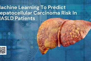 Machine Learning Model To Predict Hepatocellular Carcinoma Risk In MASLD Patients