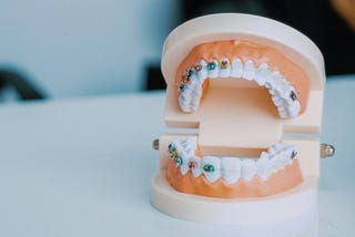 The Basics of Orthodontics: What You Need to Know