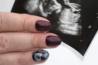 TRENDING: Ultrasound nails