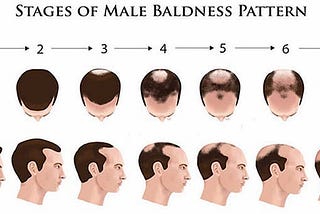 Effective Treatments for Male Pattern Baldness in 2024