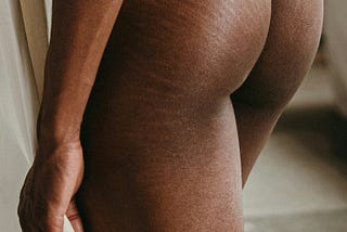 How do you get rid of stretch marks?