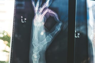 Don’t Let Stress Weaken Your Bones — Act Today!
