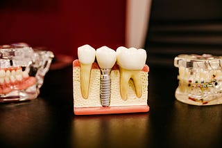Robotic Precision in Implant Surgery: Streamlining Recovery with Automated Systems