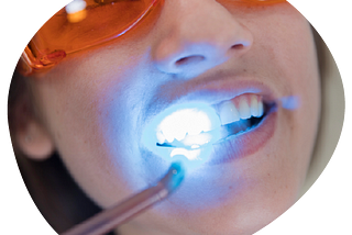 Laser teeth whitening in Bangalore| Laser Dentistry — Beyond Smiles Dental Clinic