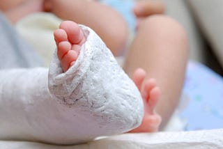 Living with a Club Foot: It’s a Wild Ride!