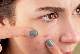 15 Most Common Skin Conditions And Best Treatment Options