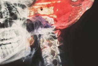 x-ray of a skull with a red monster inside