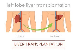 The Significance of a Liver Transplant