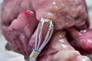 Image of Lesley-Ann Daly’s cardiac monitor device attached to a silicone heart